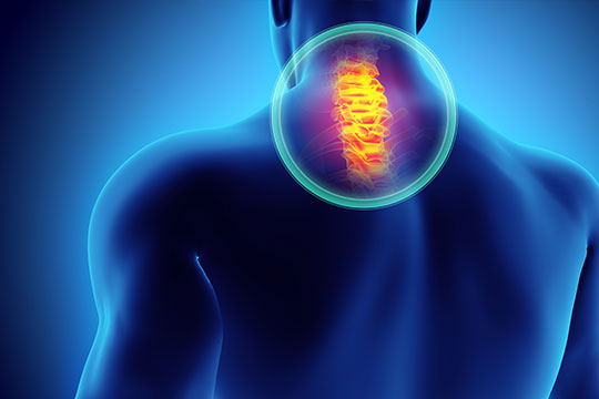 common location of neck pain on 3d diagram