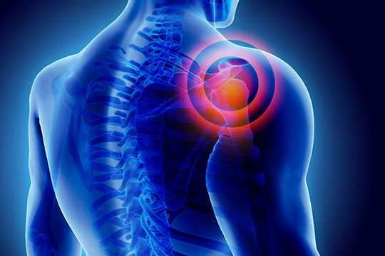 3d diagram of human body where common spot of shoulder injury is shown